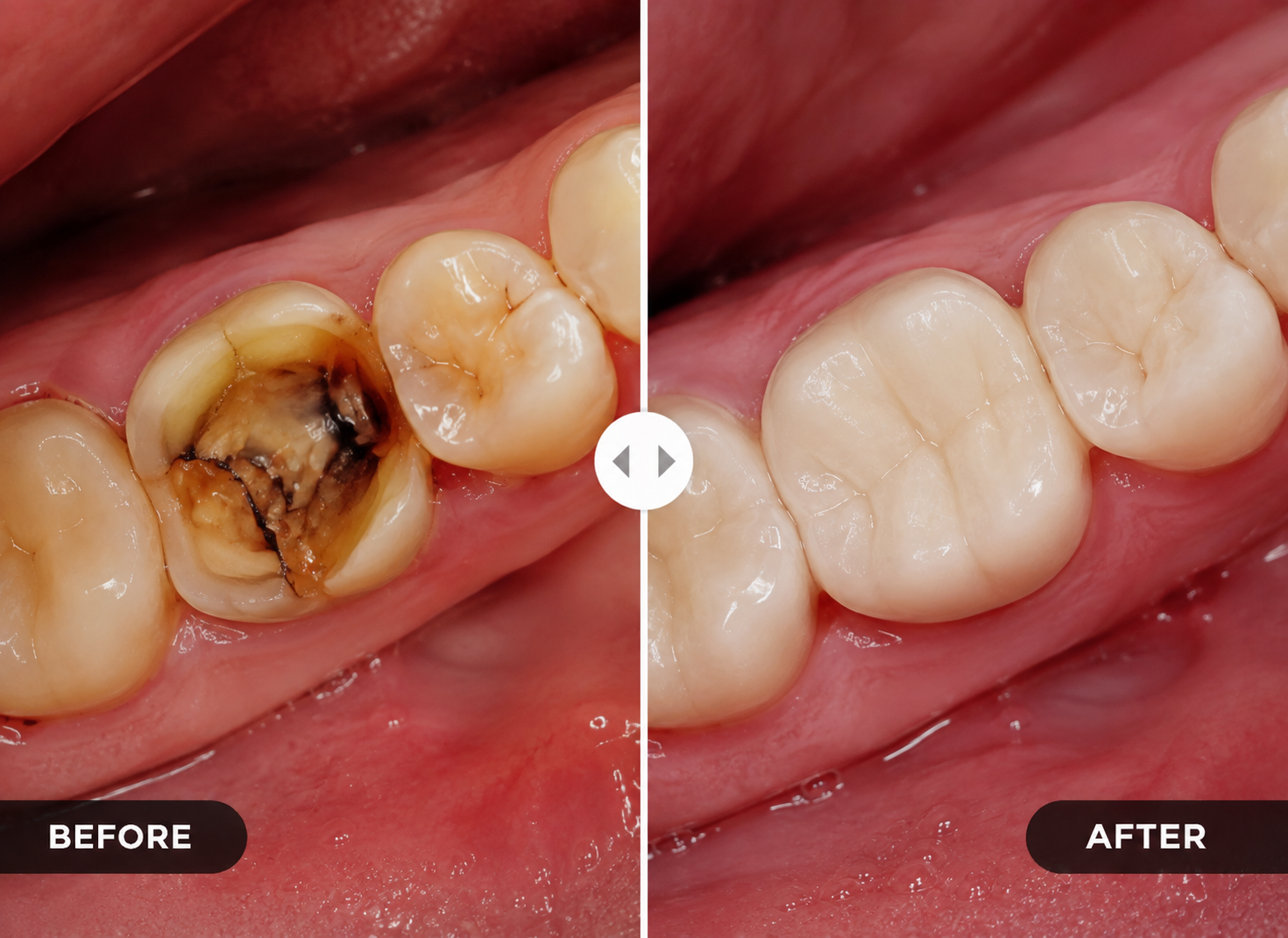 Before treatment