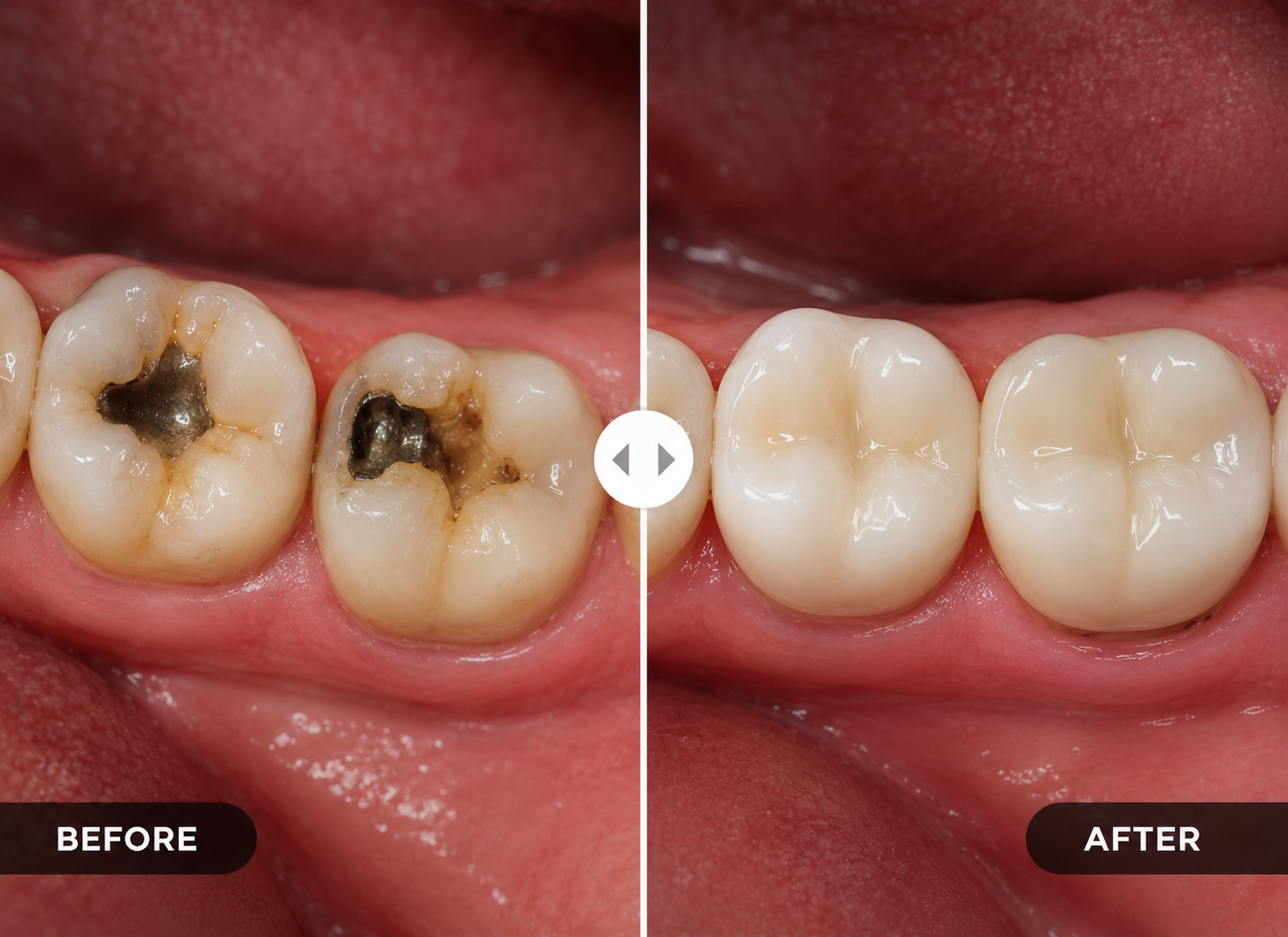 Before treatment