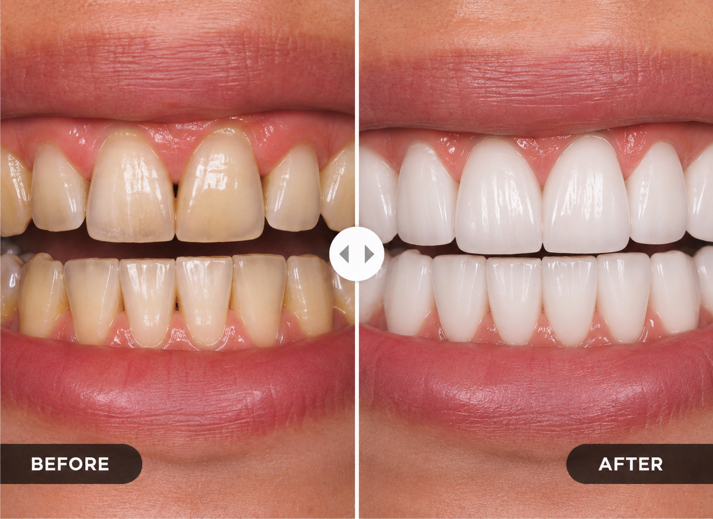 Before treatment