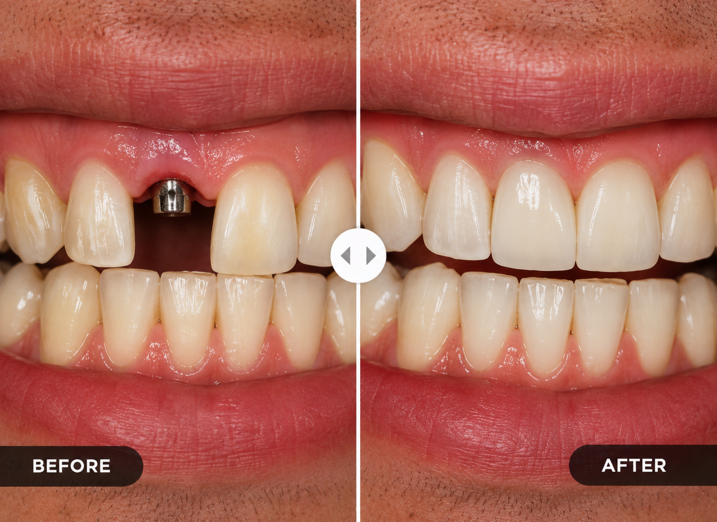 Before treatment